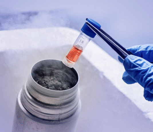 Stem Cell Therapy: The Future of Regenerative Medicine